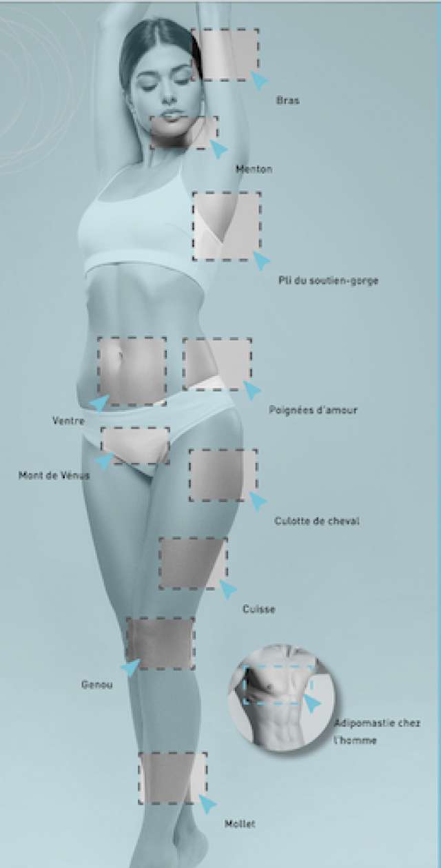 CRYOLIPOLYSE CRISTAL PRO®